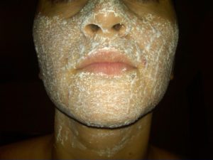 poti-folosi-aspirina-pentru-lucruri-la-care-nu-te-astepti-1