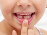 Dinţii de lapte căzuţi de la copii sunt „comori de aur”! Motivul pentru care să nu-i arunci