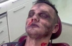 Mihai Trăistariu, la un pas de moarte. Artistul a fost resuscitat timp de 10 minute