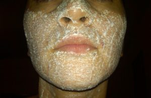 Poti folosi aspirina pentru lucruri la care nu te astepti