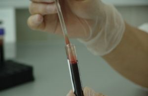 Detectat din timp, cancerul poate fi stopat înainte de a se ajunge prea departe