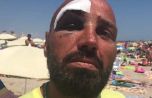 Salvamar rupt în bătaie de un turist arab, în Costineşti, în timp ce încerca să salveze două fete