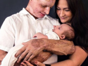 Daniel Rotaru, românul desfigurat cu acid sulfuric de fosta iubită, s-a căsătorit cu asistenta care are grijă de el