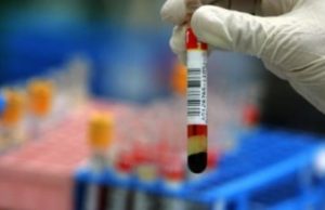 Cercetătorii au reușit să elimine virusul HIV din ADN-ul unor cobai