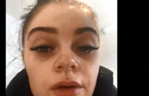 FOTO / Pericolul din spatele genelor false! O studentă de 20 de ani a rămas oarbă