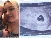 A pierdut sarcina după ce a stat 12 ore la Urgențe: „Nu vreau ca nimeni să treacă prin ce am trecut eu în acea zi” | Demamici.ro