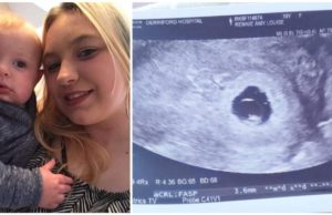 A pierdut sarcina după ce a stat 12 ore la Urgențe: „Nu vreau ca nimeni să treacă prin ce am trecut eu în acea zi” | Demamici.ro