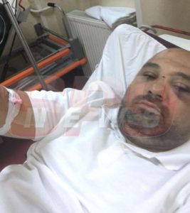 8CA5AACE-1B22-4225-AEA2-796DDD62D79D