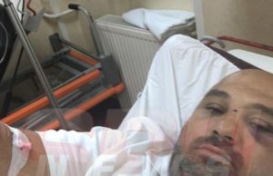 Exclusiv / Un manelist celebru a fost bătut măr de invitaţi, la un eveniment. Artistul a ajuns în stare gravă la spital