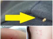 Invazie în toată țara! Ce trebuie să faci dacă te-a ciupit tigrul platanului! Insecta face ravagii!