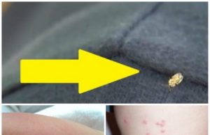 Invazie în toată țara! Ce trebuie să faci dacă te-a ciupit tigrul platanului! Insecta face ravagii!