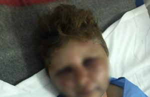 Mărturisiri cutremurătoare făcute de femeia desfigurată de un polițist căruia i-a refuzat avansurile: ”Mi-a spus că ies doar cu picioarele înainte”