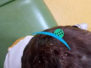 Copii cu pielea infectată, flămânzi și ținuți în mizerie, la Suceava. Mama nu-i spală, au păduchi și sunt plini de bube, acuză vecinii