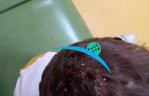 Copii cu pielea infectată, flămânzi și ținuți în mizerie, la Suceava. Mama nu-i spală, au păduchi și sunt plini de bube, acuză vecinii