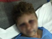 Femeie desfigurată în bătaie de un poliţist din Olt: ‘A zis că mă îngroapă în curte’