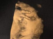 Un bebeluș nenăscut i-a spus mamei sale „du-te dracu” în timpul unei scanări cu ultrasunete