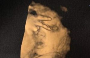 Un bebeluș nenăscut i-a spus mamei sale „du-te dracu” în timpul unei scanări cu ultrasunete