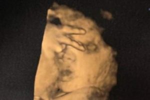 9A44279B-A5BE-42C7-9AEB-0625E55C9C39