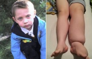 Gabriel are nevoie în continuare de ajutorul nostru pentru a se face bine. Doar aşa poate ajunge în Franţa, unde luna aceasta va fi operat