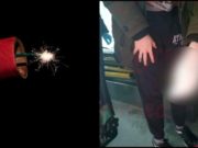 Un tânăr de 18 ani din Bârlad a rămas fără un deget, după o distracţie cu petarde