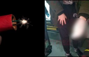 Un tânăr de 18 ani din Bârlad a rămas fără un deget, după o distracţie cu petarde