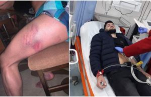 Doi interlopi din clanul Sprânceană, sechestraţi şi bătuţi cu ranga în Arad, în noaptea de Anul Nou