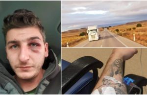 Şofer român de TIR bătut de patronii pentru care lucra, în Spania. L-au ameninţat cu moartea, dacă face plângere