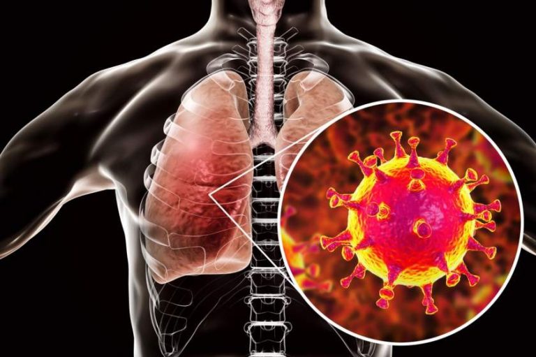 Cum arată o tulpină de coronavirus la microscopul cu electroni