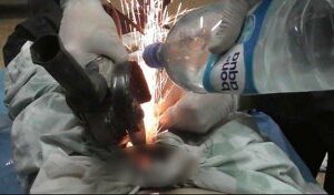 Un bărbat a ajuns la urgenţe după ce soţia i-a pus pe organul genital o piuliţă uriaşă. Operaţiunea de salvare, foarte dificilă