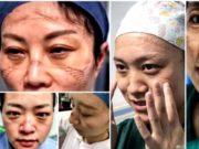 Medicii din China care salveză pacienții de coronavirus sunt plini de răni pe mâini și pe față, poartă scutece și dorm pe holurile spitalelor.