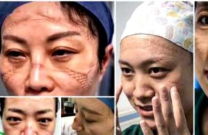 Medicii din China care salveză pacienții de coronavirus sunt plini de răni pe mâini și pe față, poartă scutece și dorm pe holurile spitalelor.