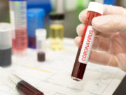 Italianul cu coronavirus întors din România a fost în Craiova timp de patru zile