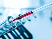 Medicamentul pe care Japonia vrea să îl folosească pentru a trata coronavirusul