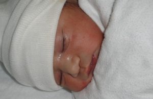 11 nou-născuți de la maternitatea Odobescu din Timișoara, confirmați cu coronavirus. Micuții s-ar fi infectat de la asistentele care i-au îngrijit