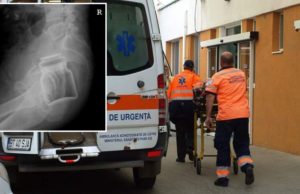 Un botoșănean care anul trecut a ajuns la spital cu un pahar in fund a venit anul acesta cu un borcan băgat acolo