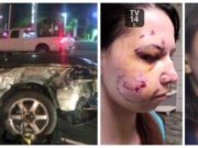 Tânără desfigurată în urma unui accident rutier: ”Medicii m-au lăsat ore în șir să sângerez, având cioburi în față!” Cum arată acum, după o operație de reconstrucție facială”
