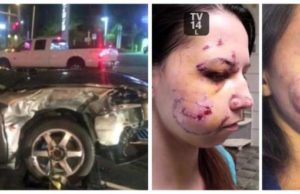 Tânără desfigurată în urma unui accident rutier: ”Medicii m-au lăsat ore în șir să sângerez, având cioburi în față!” Cum arată acum, după o operație de reconstrucție facială”