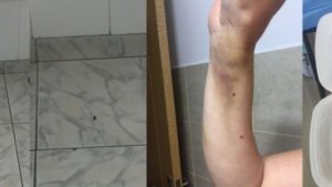 s-a-dus-la-spital-muscata-de-o-capusa-dar-a-trait-clipe-de-cosmar-ma-intrebam-ce-caut-eu-aici-toata-667294