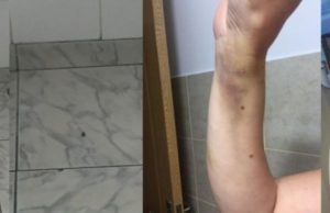 S-a dus la spital mușcată de o căpușă, dar a trăit clipe de coșmar: „Mă întrebam ce caut eu aici. Toată noaptea am plâns”