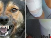 Câinii vagabonzi fac ravagii într-o localitate din județ. Mușcată de picioare, o sătmăreancă se revoltă