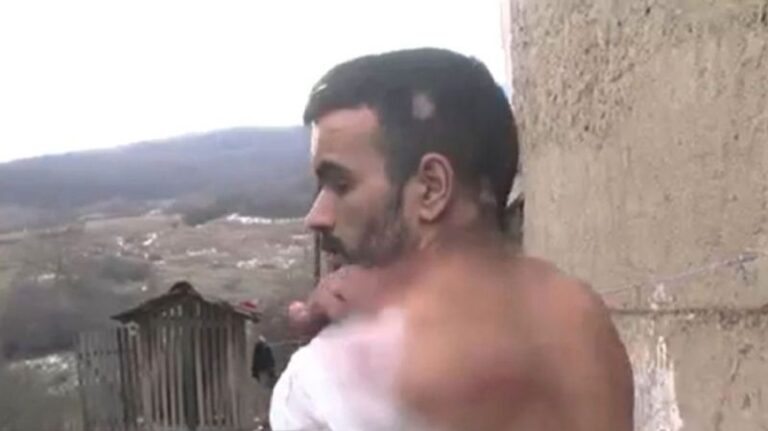 Un bărbat din Sibiu susține că a fost bătut cu bestialitate de către un polițist! „Mi-a dat cu parul…”