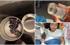 Fetiță de 4 ani, în pericol de moarte după ce a înghițit mărgelele magnetice cu care se juca. ”Nu mă voi ierta niciodată!”