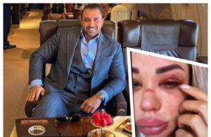 Alex Bodi, declarații exclusive despre pozele cu Bianca Drăgușanu desfigurată: „Au fost lucruri pe care le-am recunoscut”