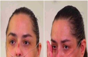 S-a vindecat de COVID după două luni petrecute la ATI. Experienţa incredibilă a unei tinere care s-a născut pentru a doua oară