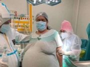 Caz incredibil într-un spital din România! Femeia a mers la doctor pentru că o durea burta! Ce au găsit medicii în abdomenul femeii!