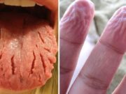 8 lucruri ciudate pe care le face corpul nostru pentru a ne proteja