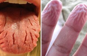 8 lucruri ciudate pe care le face corpul nostru pentru a ne proteja