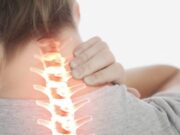 Ameteala inexplicabila, amorteala in brate- Spondiloza cervicala. Care sunt simptomele si cum se trateaza