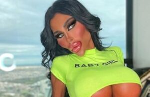 Asistenta care a uimit lumea medicală: după 5 operații estetice, vrea să-și dubleze sânii –