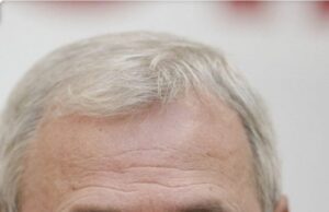 Liviu Dragnea, operat de urgență. CARE E STAREA LUI